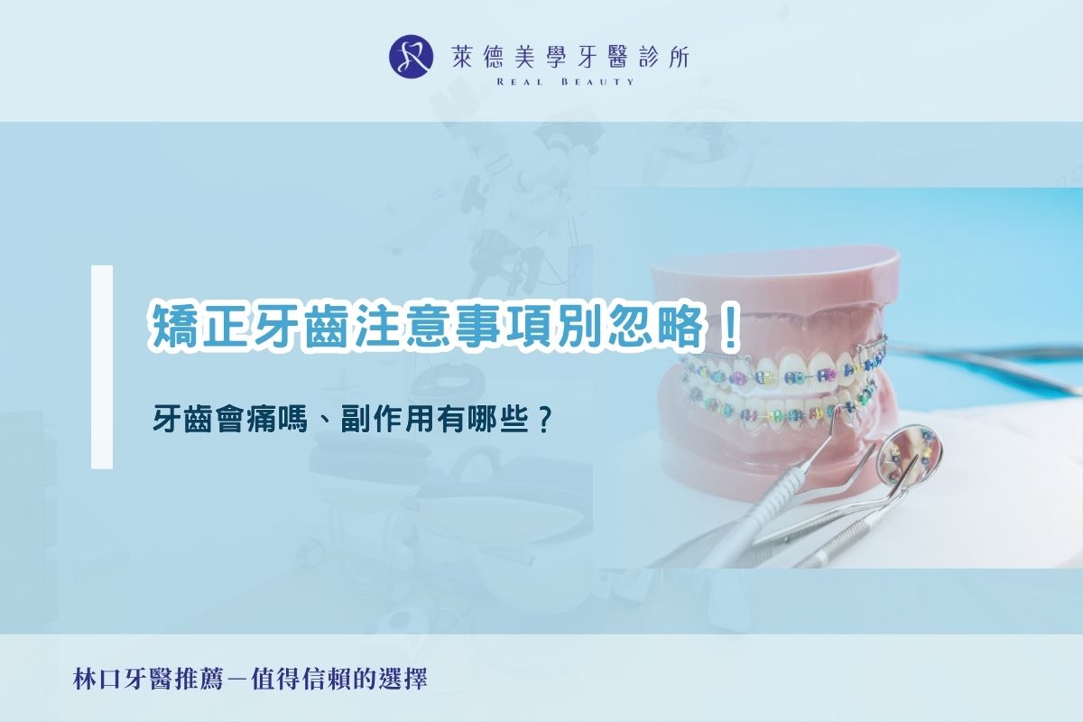 矯正牙齒注意事項別忽略！牙齒會痛嗎、副作用有哪些？