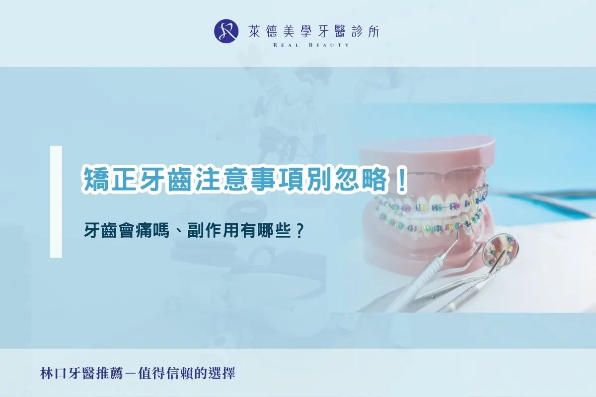 矯正牙齒注意事項別忽略！牙齒會痛嗎、副作用有哪些？