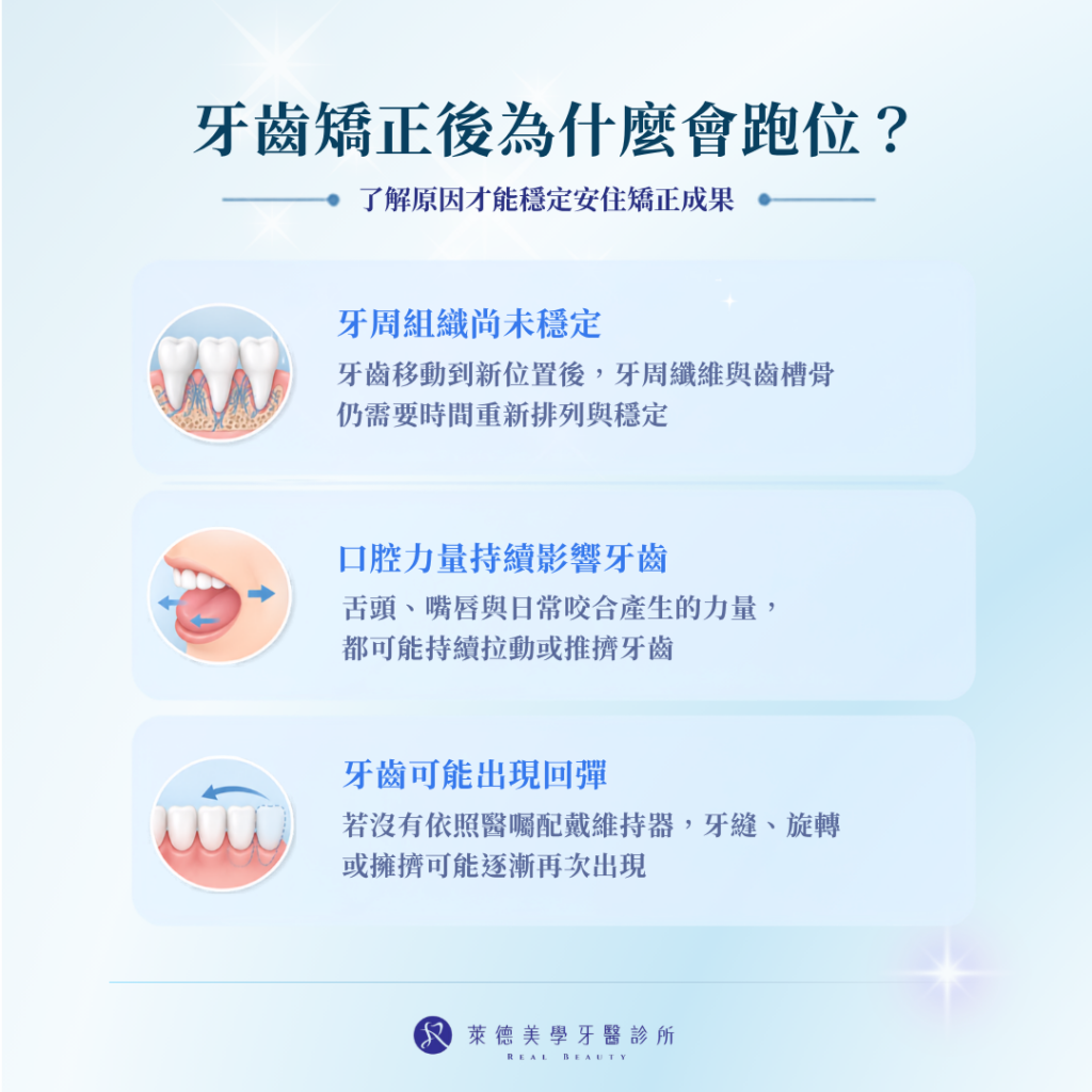 牙齒矯正後會跑掉嗎?了解維持器與矯正原理更安心 1 Orthodontics