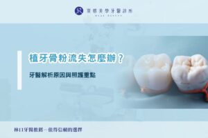 植牙骨粉流失怎麼辦?牙醫解析原因與照護重點