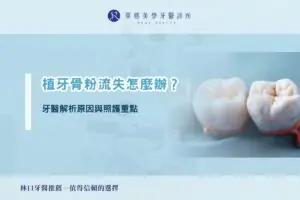 植牙骨粉流失怎麼辦？牙醫解析原因與照護重點