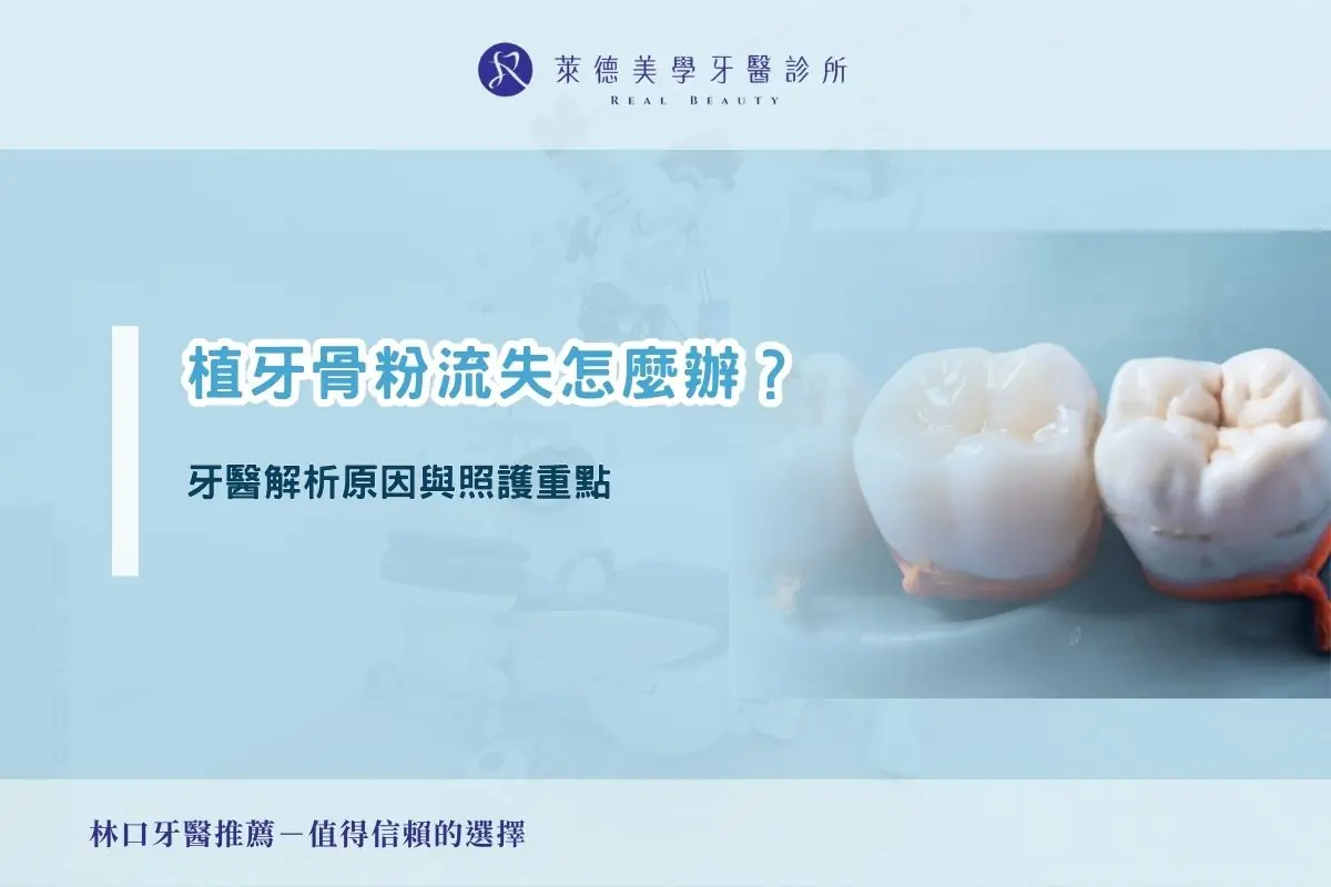 植牙骨粉流失怎麼辦？牙醫解析原因與照護重點