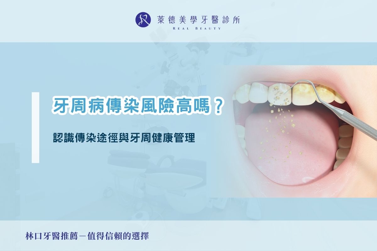 牙周病傳染風險高嗎？認識傳染途徑與牙周健康管理
