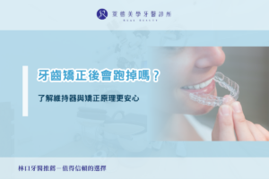 teeth Straightening