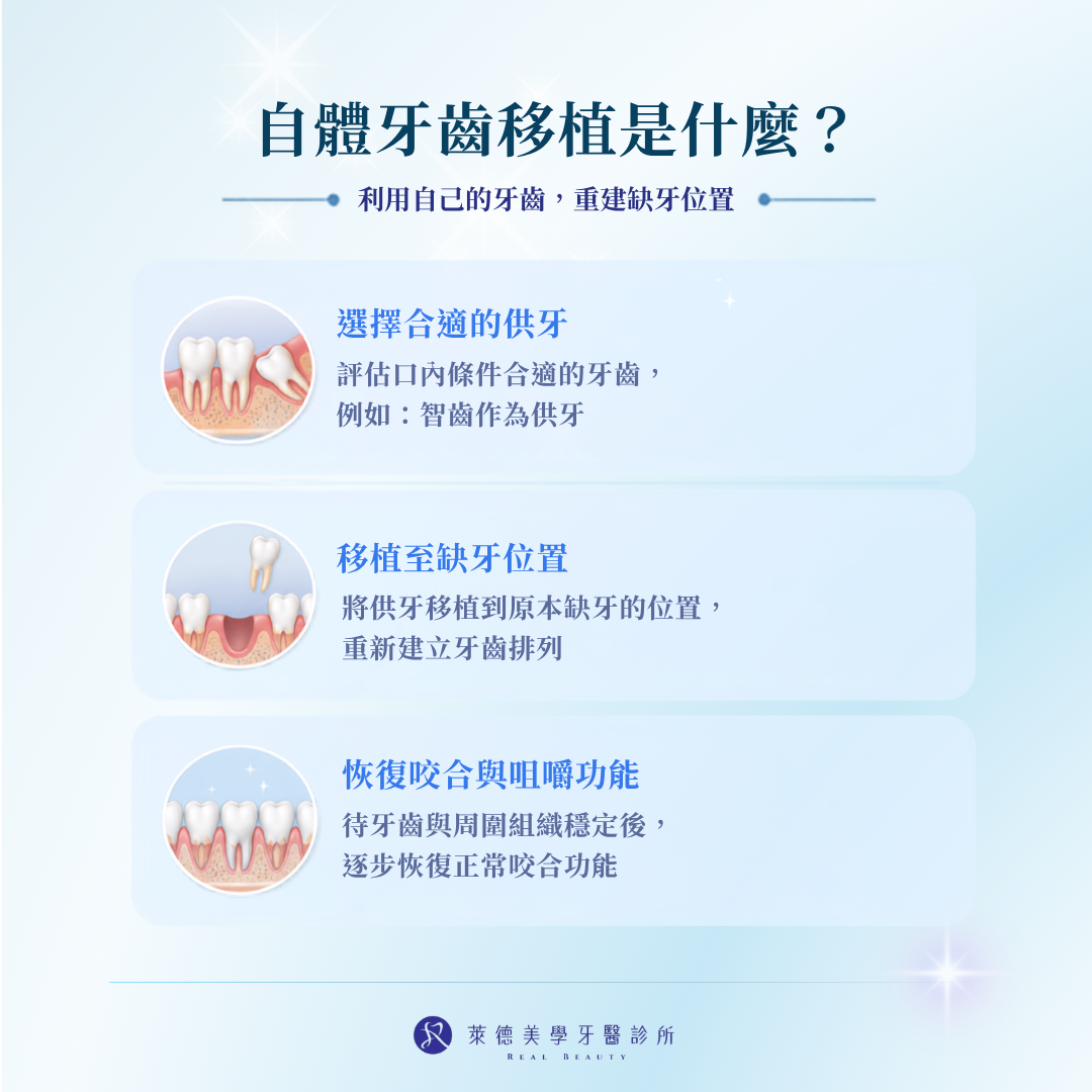 自體牙齒移植治療原理示意圖