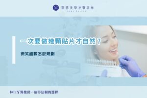 一次要做幾顆貼片才自然？微笑齒數怎麼規劃