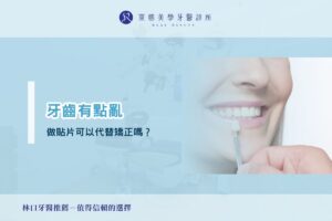 牙齒有點亂，做貼片可以代替矯正嗎？