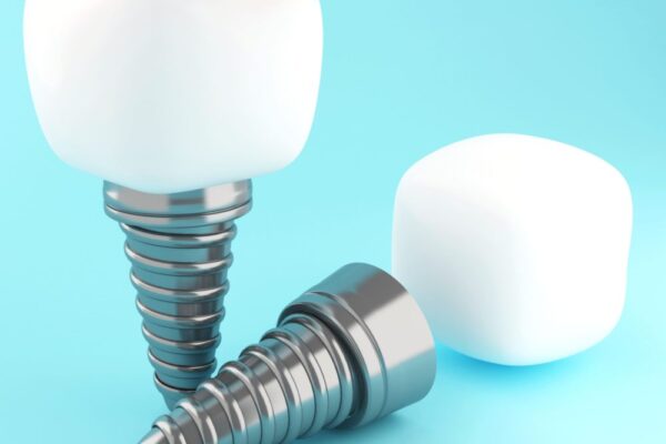 3d-dental-tooth-implant-2021-08-29-10-14-31-utc