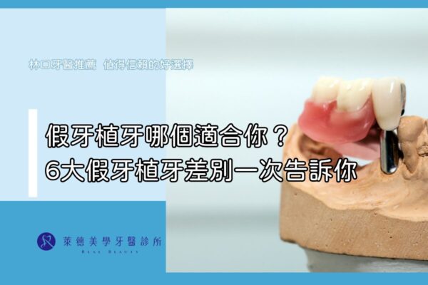 RDC2 (3)