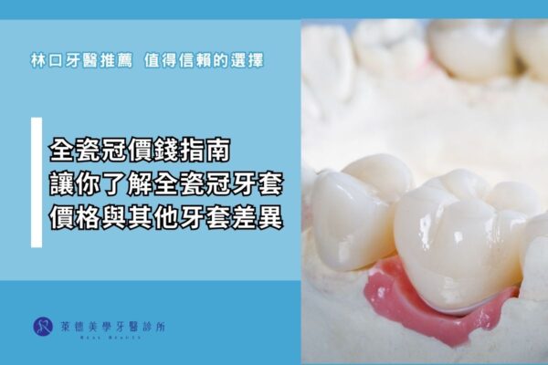all-ceramic-crown-price-guide