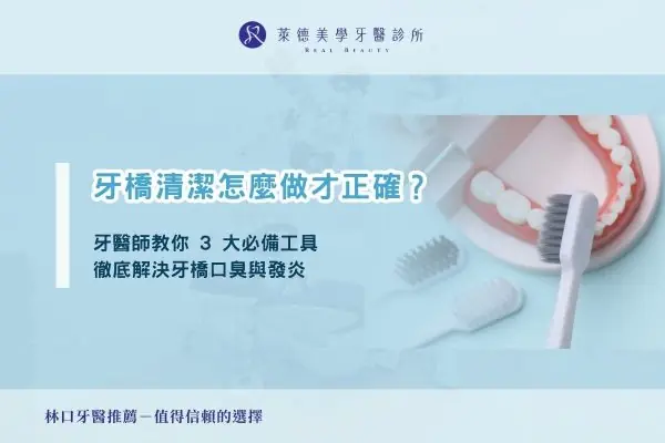牙橋清潔怎麼做才正確？牙醫師教你 3 大必備工具，徹底解決牙橋口臭與發炎