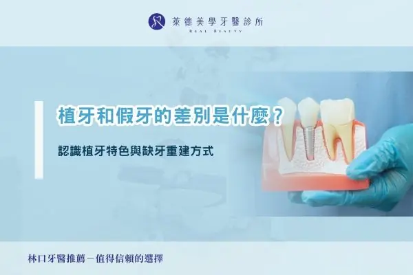 植牙和假牙的差別是什麼？認識植牙特色與缺牙重建方式