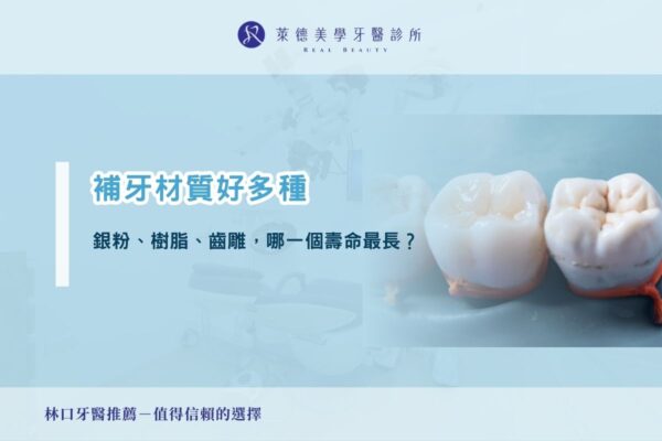 補牙材質好多種：銀粉、樹脂、齒雕，哪一個壽命最長？