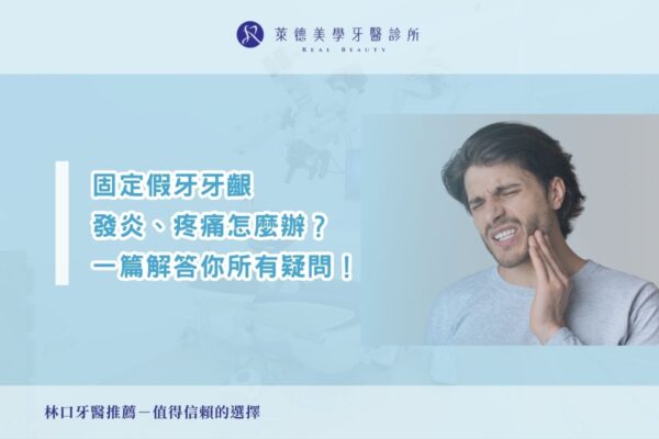 固定假牙牙齦發炎、疼痛怎麼辦？一篇解答你的所有疑問！