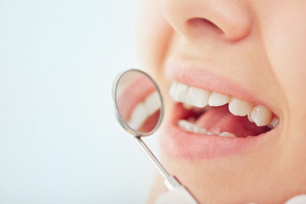 Close-up of open mouth during oral checkup at the dentist