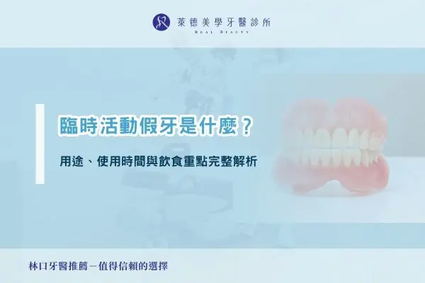 臨時活動假牙是什麼？用途、使用時間與飲食重點完整解析