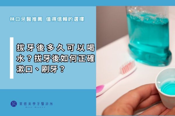 how-soon-can-you-drink-water-after-tooth-extraction