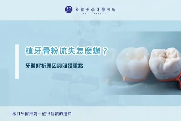 植牙骨粉流失怎麼辦？牙醫解析原因與照護重點