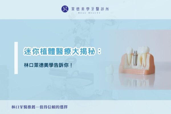 迷你植體醫療大揭秘：林口萊德美學告訴你！
