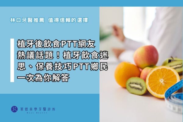 植牙後飲食ptt網友 熱議話題！植牙飲食迷思、保養技巧ptt鄉民一次為你解答