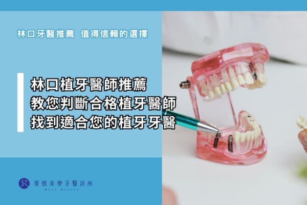 林口植牙醫師推薦 教您判斷合格植牙醫師 找到適合您的植牙牙醫