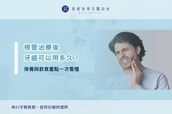 根管治療後牙齒可以用多久？保養與飲食重點一次看懂