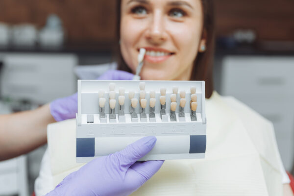 selection-of-the-correct-tooth-color-for-professio-2022-11-15-18-51-07-utc (2)