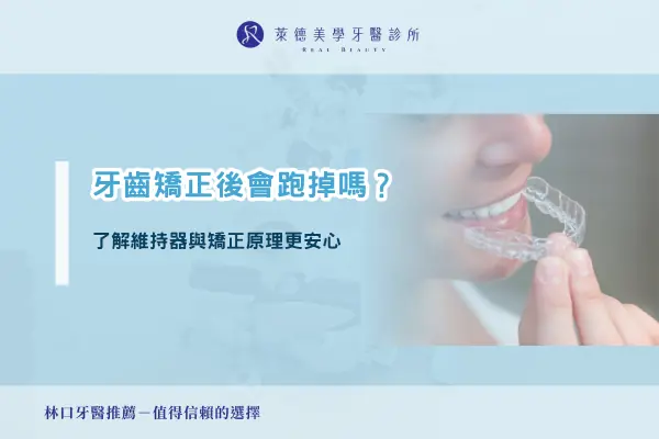 teeth Straightening