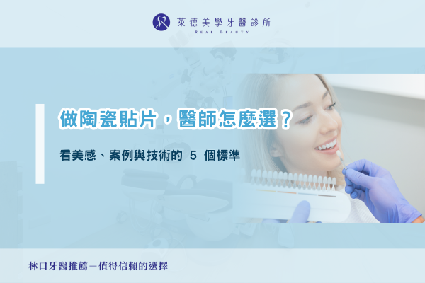veneer-dr-choose