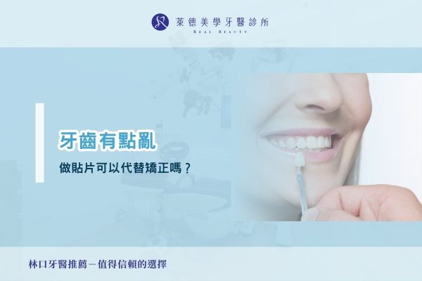 牙齒有點亂，做貼片可以代替矯正嗎？