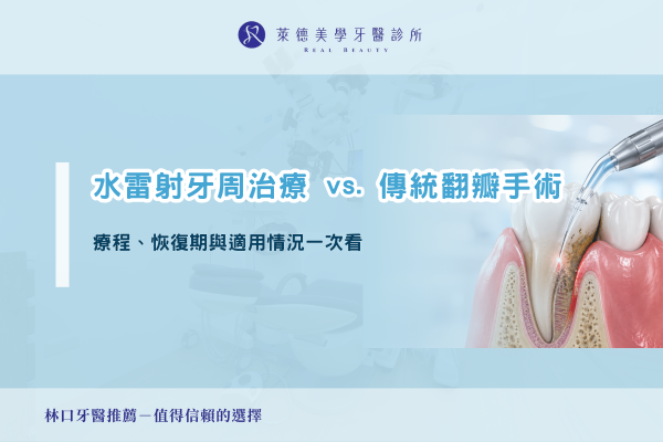 water-laser-periodontal-treatment-vs-flap-surgery
