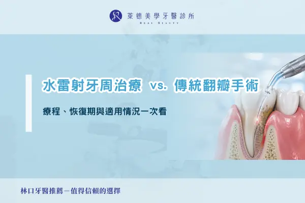 water-laser-periodontal-treatment-vs-flap-surgery