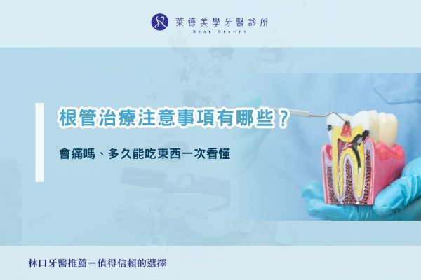 根管治療注意事項有哪些？會痛嗎、多久能吃東西一次看懂