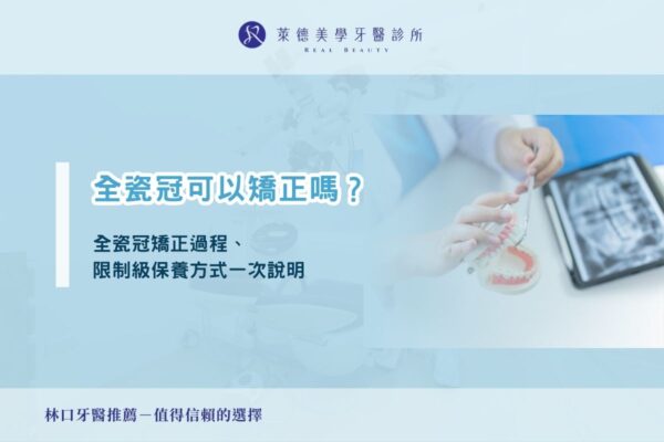 全瓷冠可以矯正嗎？全瓷冠矯正過程、限制級保養方式一次說明